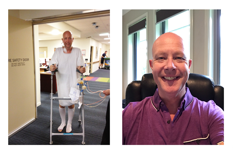Left image: Mark in hospital following surgery, standing with a walker in a hallway while wearing a white hospital gown and compression stockings. This image captures a moment of determination and early recovery during his treatment for pancreatic cancer. Right image:Mark smiling brightly at home, wearing a purple polo shirt and seated in a leather office chair. The natural light and relaxed setting highlight a positive and hopeful outlook after treatment.