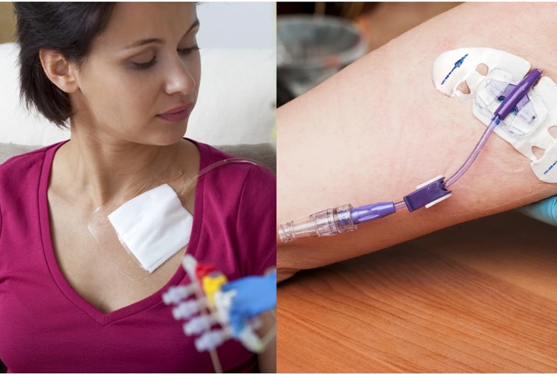chemotherapy devices PICC and port